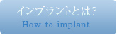 インプラントとは?